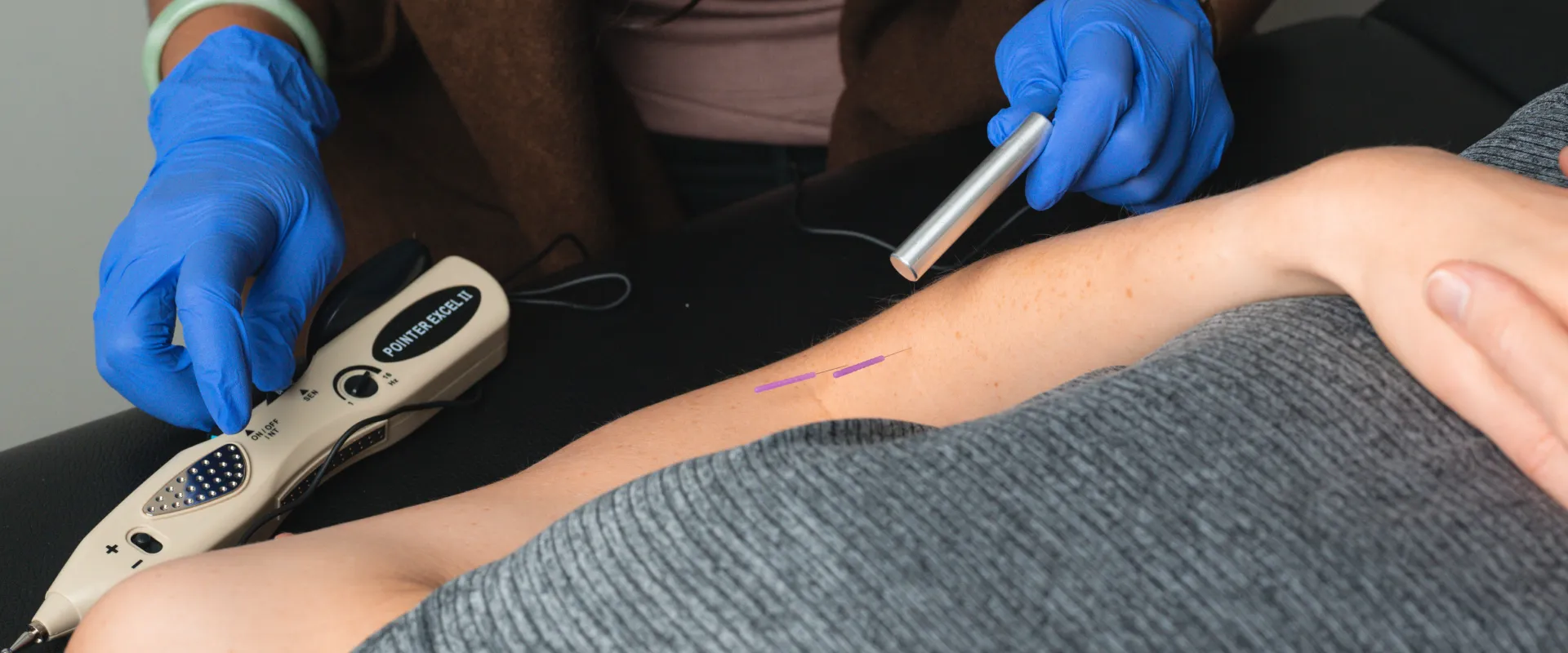 Dry Needling